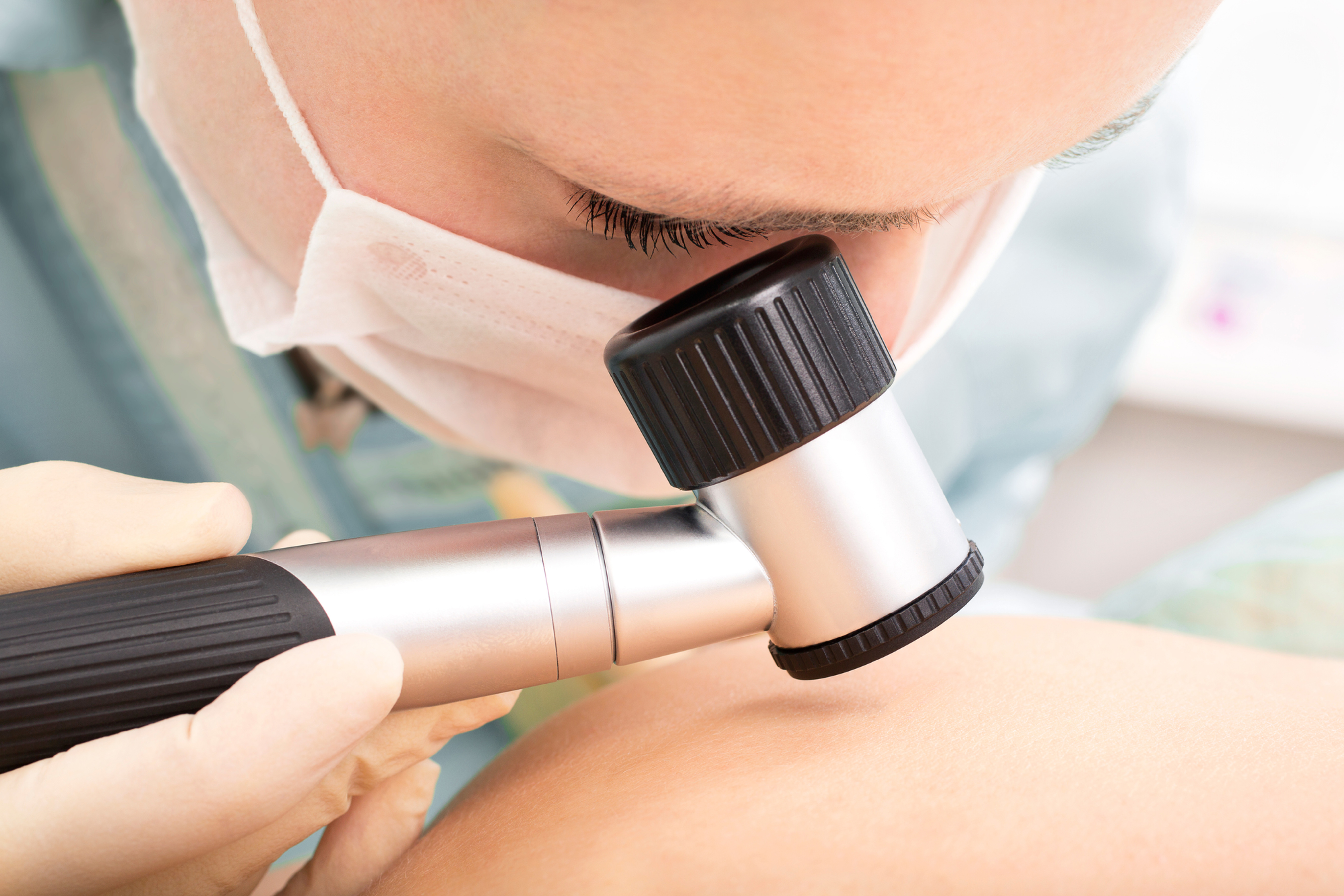 カラーアトラスdermoscopy Polarized Light Dermoscopy: Clearer Skin dermatoscope Lesion